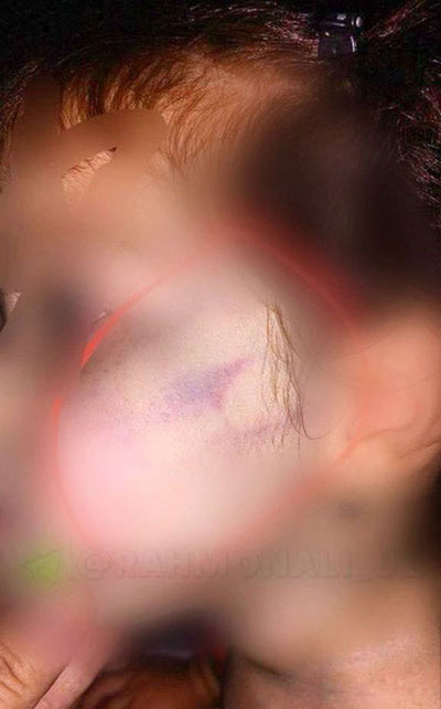 Изрображение 'В Алмалыке воспитательница частного детсада побила 2-летнюю воспитанницу'