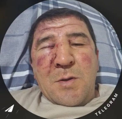 'Фарғонада фермер ҳақини сўрагани учун калтаклангани айтилмоқда'ning rasmi