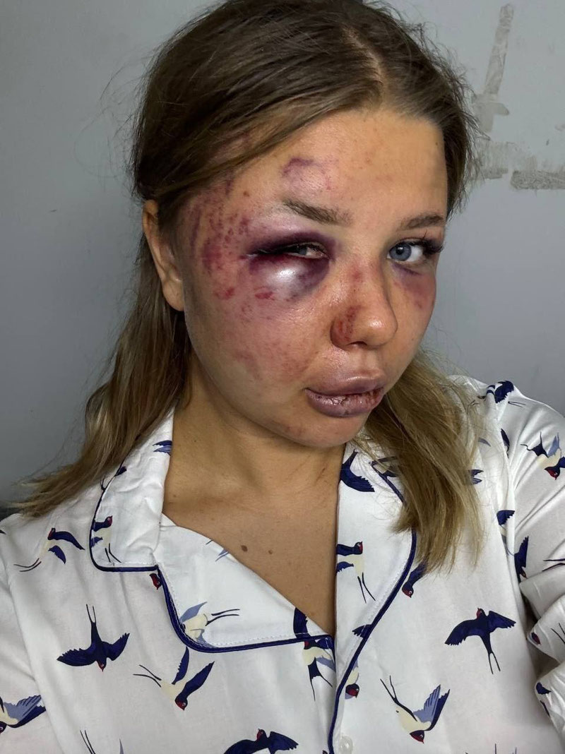 'Доғистонлик ММА жангчиси 20 ёшли қизни калтаклашда гумонланмоқда'ning rasmi