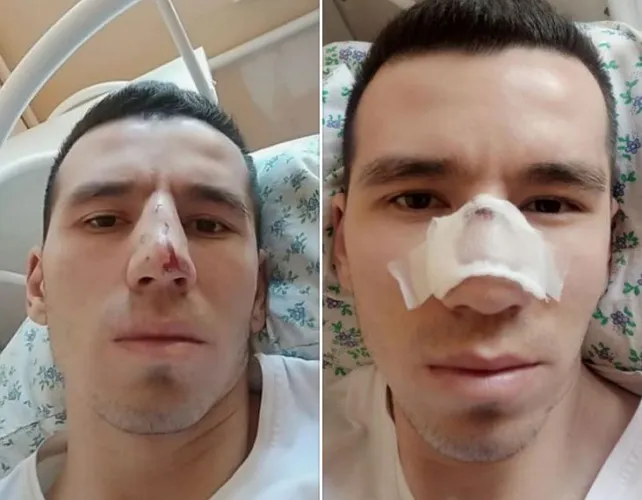 'Соғлиқни сақлаш вазири тажовузга учраган тез тиббий ёрдам ходими ҳолидан хабар олди'ning rasmi